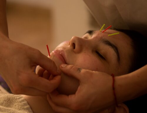 Crece la demanda de Acupuntura Profesional en La Pobla de Vallbona